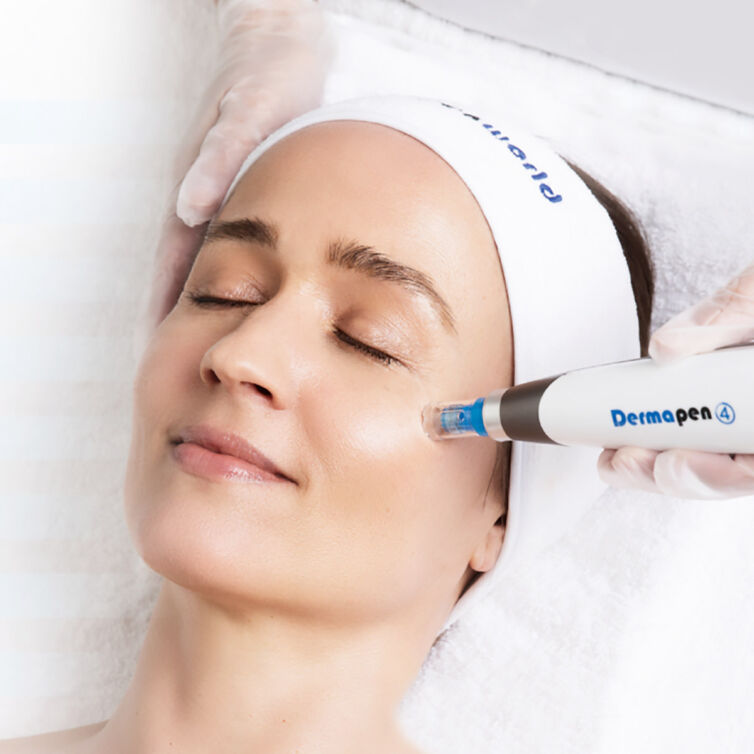 Microneedling